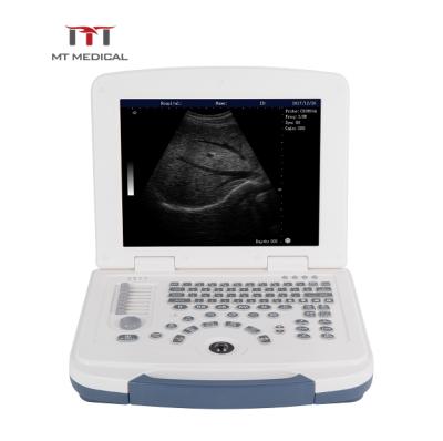 China Metal MT Laptop Medical Hot Selling Portable Ultrasound Black And White Machine zu verkaufen