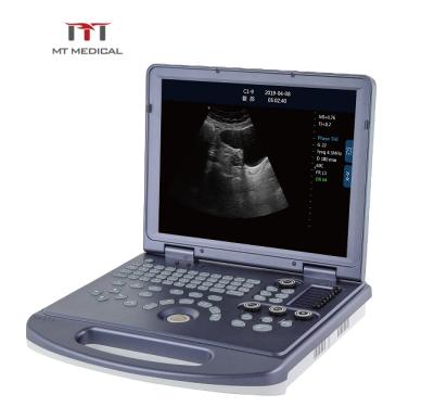 China Metal Ultrasound Manufacturing Clear Performance Portable Laptop Ultrasound Scanner Machine Price zu verkaufen