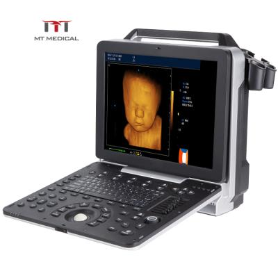 China Metal Clear Imaging Portable Digital 3D/4D Color Doppler Echocardiography Cardiac Ultrasound Machine zu verkaufen