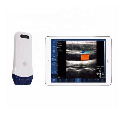 Κίνα Steel Portable Wireless Color Doppler Ultrasound Linear Probe / Machine / Equipments προς πώληση