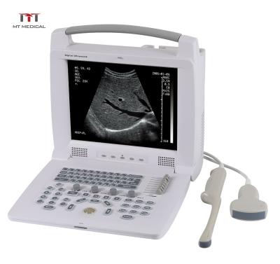 China Metal MT China Digital Medical Portable Veterinary Ultrasound Price zu verkaufen