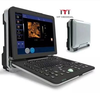 China Metal Ten 128 Probe Elements Optional Portable CW 3D/4D Color Doppler Ultrasound Machine zu verkaufen