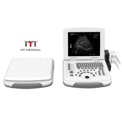 China Portable ABS Digital Laptop Color Doppler Ultrasound Machine zu verkaufen