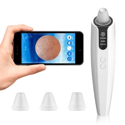 China Acne Treatment Mini Silicone Blackhead Remover Kit Pore Vacuum Blackhead Remover Portable Power Tool for sale