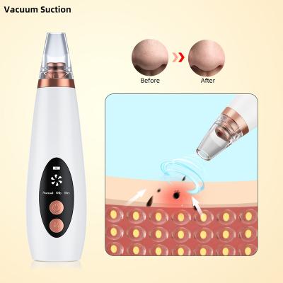 China Acne Treatment Skin Care Beauty Equipment Factory Price Blackhead Pore Remover 6 In 1 Vacuum Blackhead Remover for sale