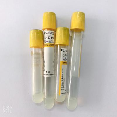 China Serum, das gelbes Vakuumdes abgehobenen betrages Kappe vacuum blood colletion tube 5ml genaues Volumen trennt zu verkaufen