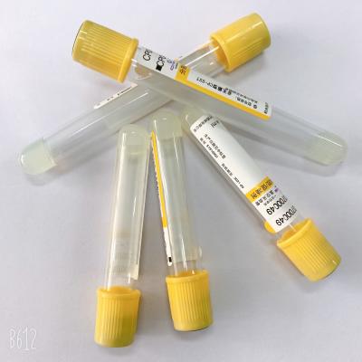 China Single Use Gel And Clot Activator Tube Phlebotomy PRP Blood Collection Tubes for sale