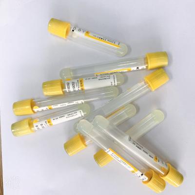 Chine Le plastique/tubes de verre jaunissent le sang supérieur de tube rassemblant l'anticoagulant à vendre