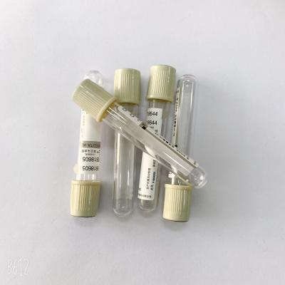 Chine Phlebotomy de tube de sang de glucose de Na 2 d'EDTA de code à couleurs pour le Hemolysis de sucre à vendre