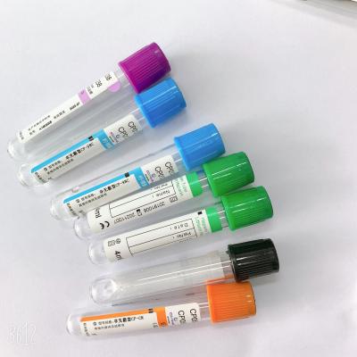 China Steriles 5ml Blutprobe-Rohr-Antigerinnungsmittel der Serum-Beispielrohr-Blau-Spitze zu verkaufen