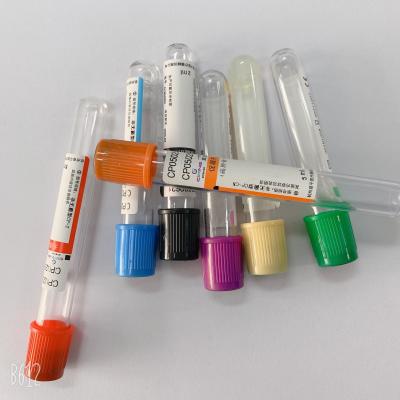 China High Concentration PRP Blood Test Tube With Upgrade ACD Gel Easy To Use for sale