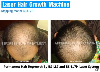 China Laser hair regrowth equipment Beauty Salon Laser Hair Regrowth Machine For Hair Loss Treatment factory direct wholesale for sale