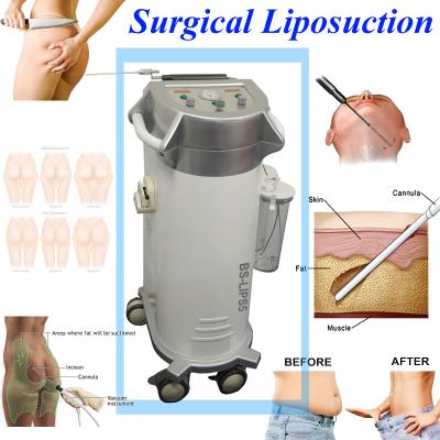 China Low Noise Body Shaped Power Assisted Liposuction Equipment For Hospital for sale