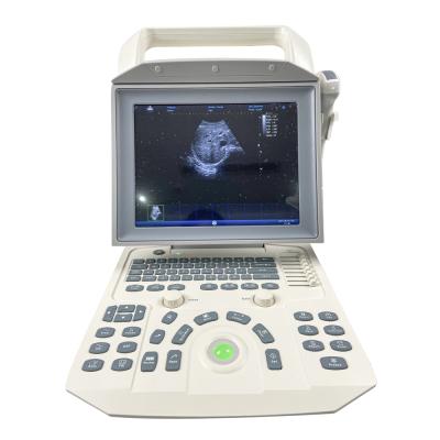 China Sale Low Price Diagnostic Ultrasound Metal B/w Portable Ultrasound Machine Machine-Machine for sale