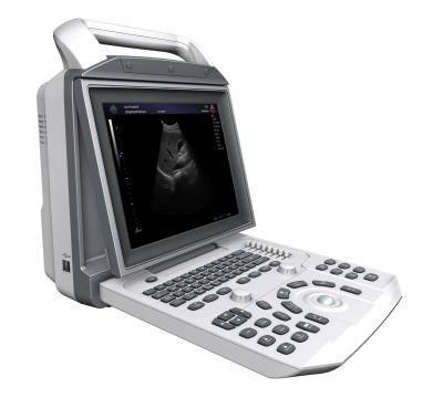 China Portable Black And White Abdomen Ultrasound Scanner With PW Mode for sale