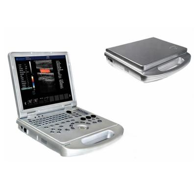 China Metal Color Doppler Double Screen Trolley 4D Ultrasound Scanner Hospital Echo Machine for sale