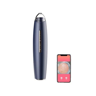 China Acne Treatment Blackhead Remover Pore Vacuum Cleaner With Microscope Built-in Visual Acne Wi-Fi Cleaning Remover for sale