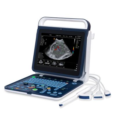 China High Quality Medical Handheld Color Doppler System Hd Display Color Ultrasound Scanning System for sale