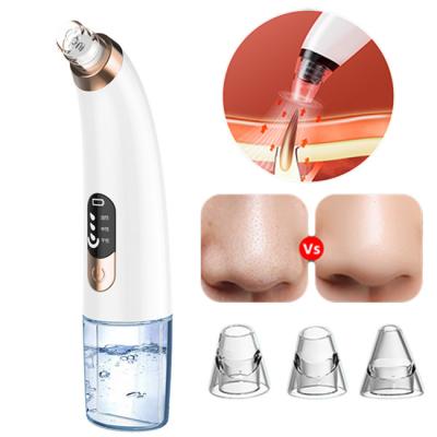 China Strong Acne Treatment Acne Remove Blackheads Peer Vacuum Suction Blackhead Remover for sale