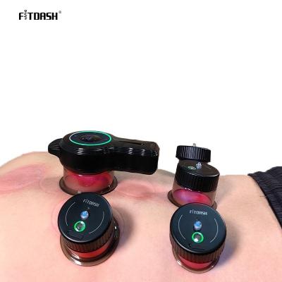 China Efficiently Stimulate Blood Circulation with Our Smart Cupping Therapy Vacuum Therapy Set for sale