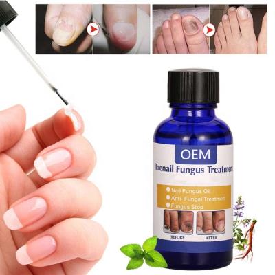 China Repair Private Label Nail Treatment Care Care Nail Fungus Liquid for sale