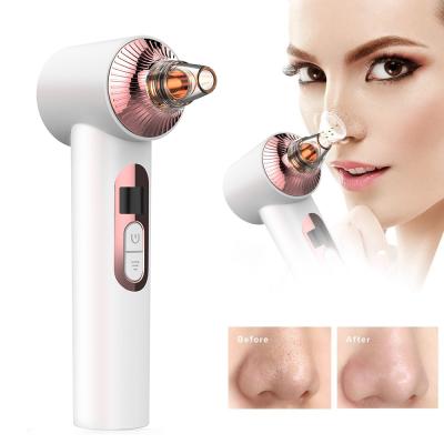 China Electric Acne Treatment Pore Cleansing Refillable 2021 Blackhead Remover Visual Blackhead Remover With Vacuum Suction for sale