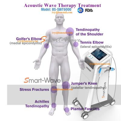 China Physiotherapy Shockwave Therapy for Knee Arthritis Symptom of Osteoarthritis for sale