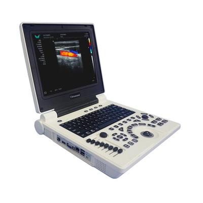 China E20 Portable Metal Notebook Color Doppler Ultrasound Machine for sale