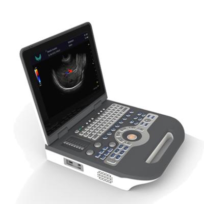 China XF3500 Portable Led Metal Laptop Color Doppler High Frequency Ultrasound Machine for sale