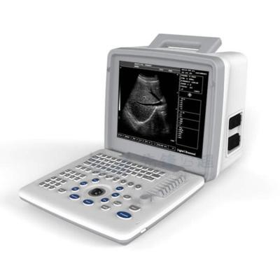 China Metal 12 Inch Black China Ultra HD White Portable Ultrasound Machine Price for sale