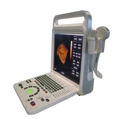 China Portable Metal Color Doppler Ultrasound Scanning Machine For Sale for sale