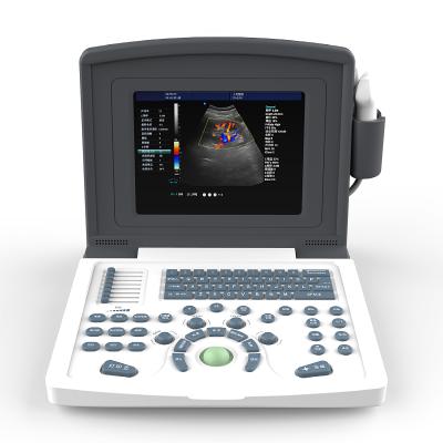 China Cheapest 12 Inch Portable Metal Color Doppler Ultrasound Machine With Probe for sale