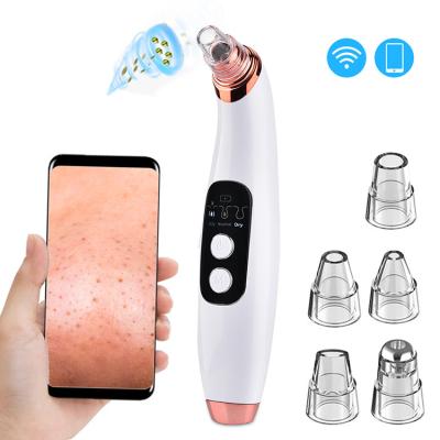 China Acne Treatment CVB-101 Hot Selling Electric Facial Blackhead Remover Vacuum for sale