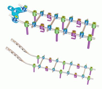 China Sistema cervical de la fijación del trasero de la ortopedia del titanio en venta