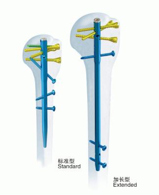 China De chirurgische Met elkaar verbindende Spijker van het Orthopedie Anatomische Opperarmbeen Te koop