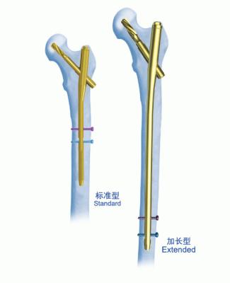 China PFNA-CER Gamma-Nagel-Fixierungs-Ineinander greifennagel zu verkaufen