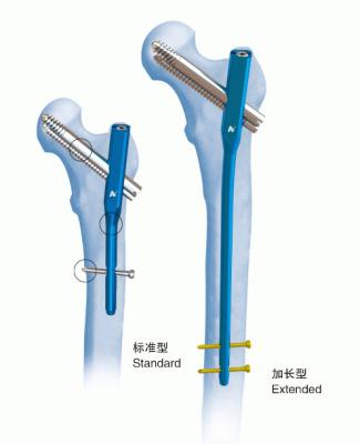 China De Gamma Met elkaar verbindende Spijker PFN van het orthopedieⅣtitanium Te koop