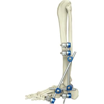 China Medical Orthopedic Instrument Ankle External Fixation Device for sale