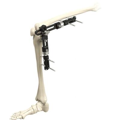 China Hoog - van de Knie Gezamenlijke Externe Fixator van kwaliteits de Orthopedische Chirurgische Instrumenten Externe Bevestiging Orthopedische Chirurgische Instrumen Te koop