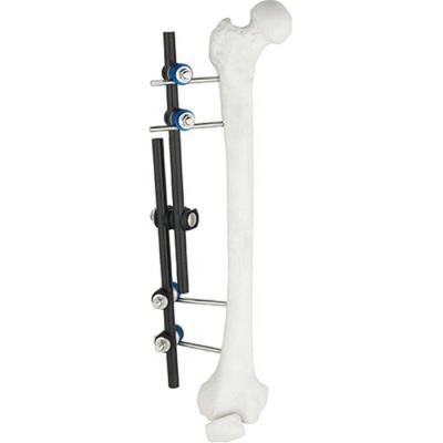 Chine Instruments chirurgicaux orthopédiques de vente chaude Tibial et instrument orthopédique de fixation externe externe de Fixator ao de fémur à vendre