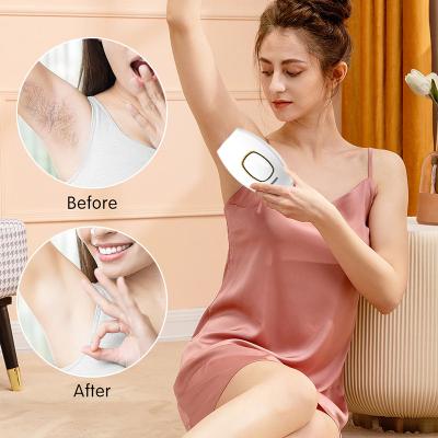 China Hair Removal Newly Improved Full Body Men And Women Instant Hair Removal 500000 Laser Painless IPL Hair Removal Machine for sale