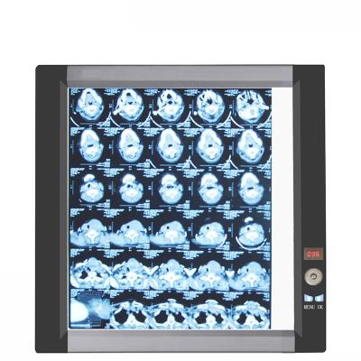 China Single Array Thin Adjustable Single Panel Unit Acrylic Portable Led X-ray Film Medical Viewer for sale