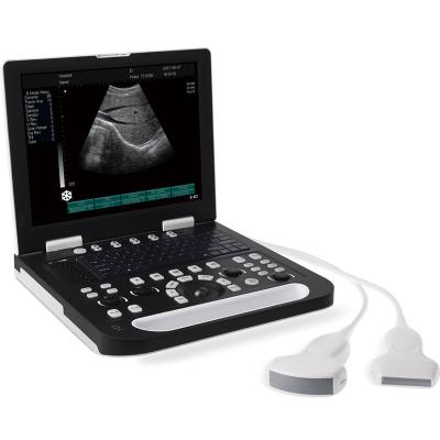 China Metal Portable Medical Ultrasonic Instruments Laptop Computer Ultrasound Diagnostic Equipment for sale