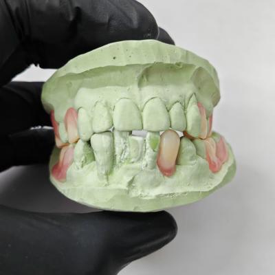 Chine Résine thermoplastique de haute précision, résine de base de dentition partielle flexible à vendre