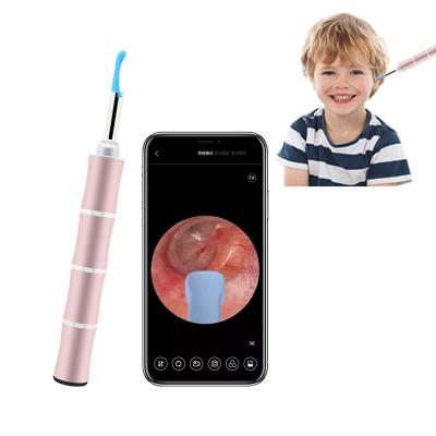 China Artiful Ear Wax Remover Viable Ear Wax Cleaner Baby Ear Noise App Tuya Cleaning Microscope for sale