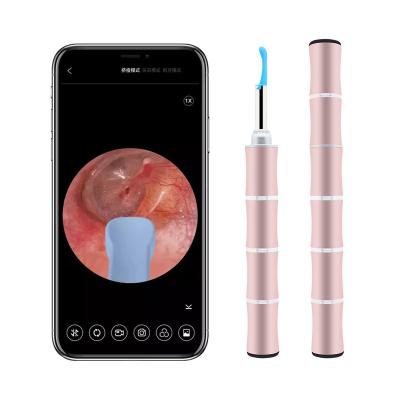 China 45 Minutes Tuya App 2022 Portable Electric Ear Harvester Earwax Remover Earwax Remover Video Endoscope for sale