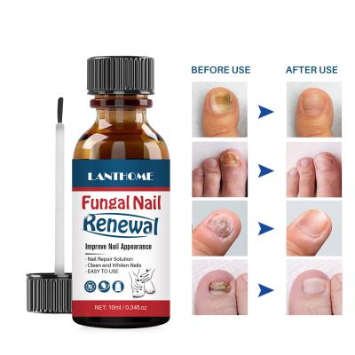 China Finger Nail Beauty Private Label OEM Fungal Nail Strengthening Treatment Renewal Foot Toe Nail Fungus Infection Hand Repair for sale