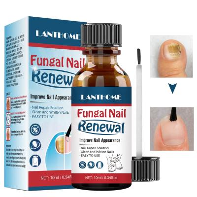 China Finger Nail Beauty Private Label Anti Fungal Nail Treatment Home Use Liquid Nail Repair Renewal for sale