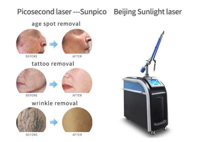 Cina Trattamento verticale dell'acne di rimozione della pigmentazione della macchina di rimozione del tatuaggio del laser di picosecondo in vendita