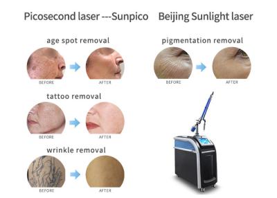 Cina Pelle che imbianca operazione facile della macchina di rimozione del tatuaggio del laser di picosecondo in vendita